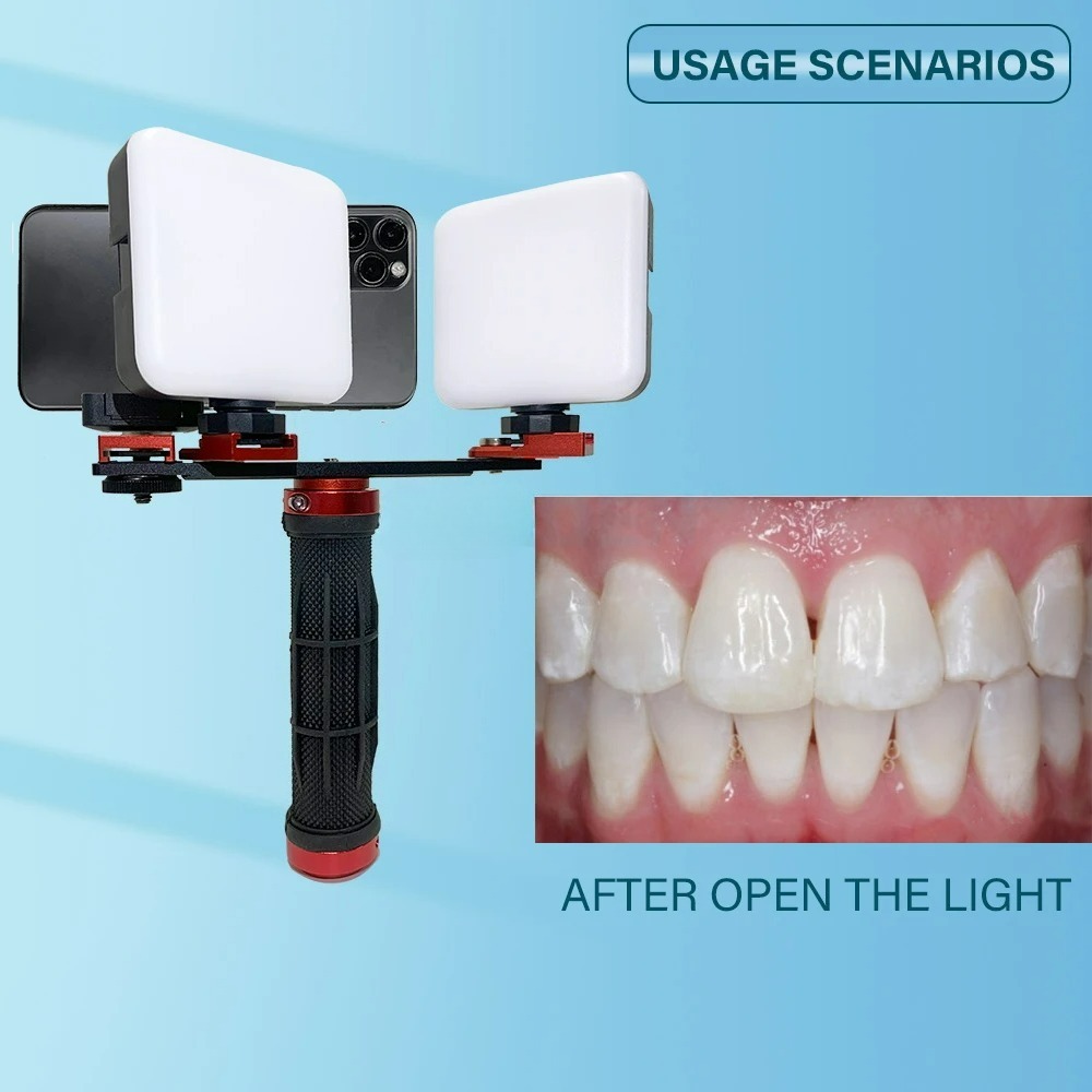 Lampa do fotografii stomatolog – Photography Lighting Accessories recenzja i cena